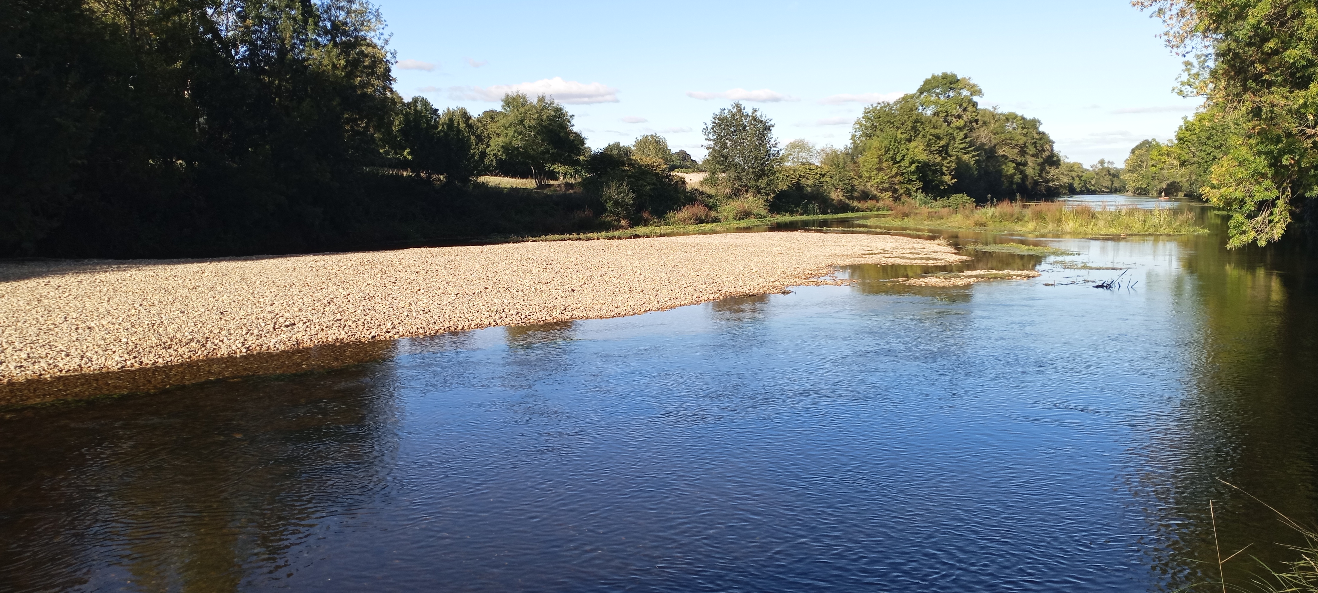 illustration 1 1 3 2 CTMA restauration morphologique